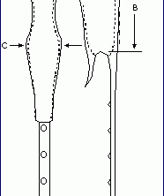 Eliachar Laryngeal Stent