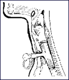 Hood Tracheal and Thoracic T-Tubes2